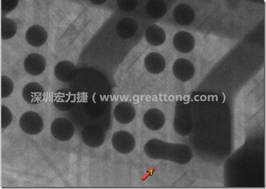 BGA因?yàn)楹笁|變小，造成錫膏過多而最終形成焊接短路的結(jié)果。